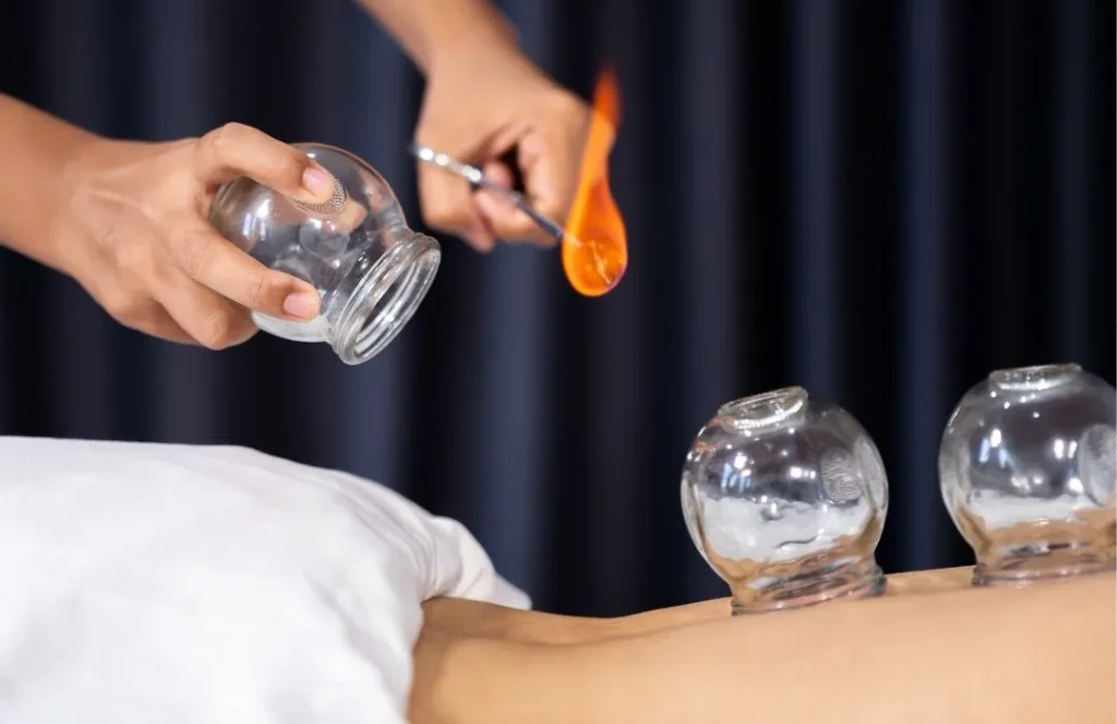 Cupping Therapy in Dhaka